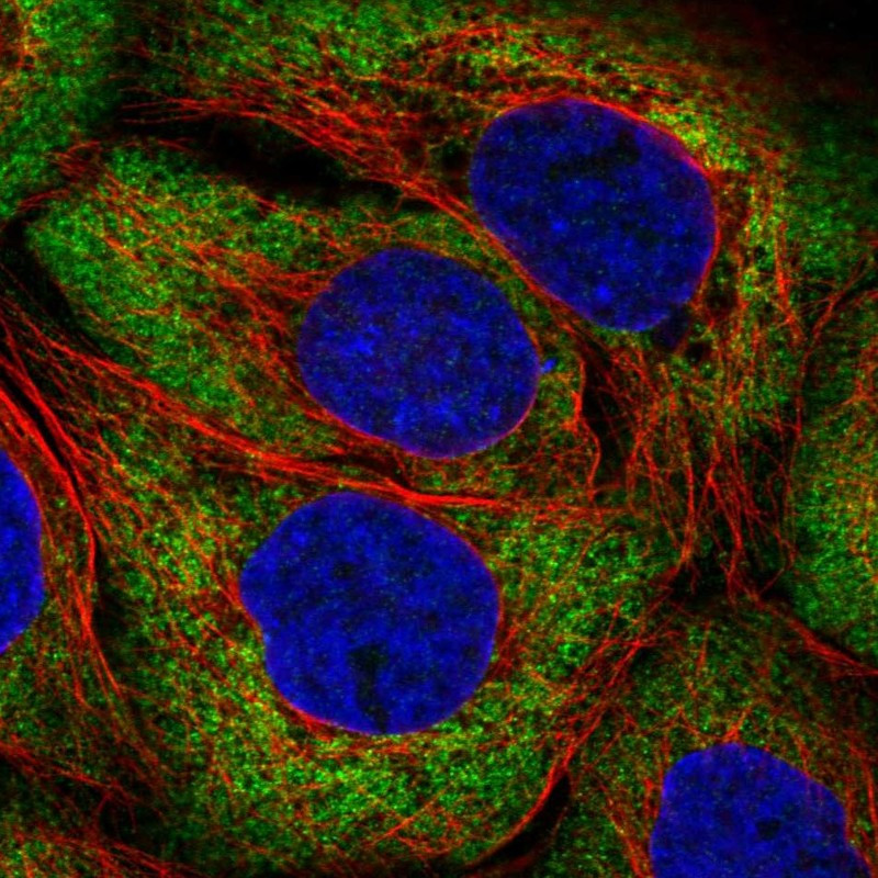 Immunofluorescent staining of human cell line A-431 shows localization to cytosol.