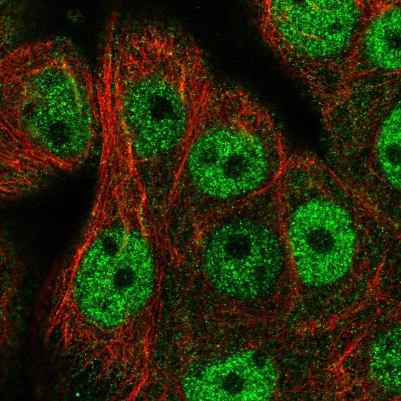Immunofluorescent staining of human cell line MCF7 shows localization to nucleoplasm & cytosol.