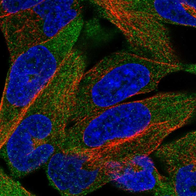 Immunofluorescent staining of human cell line RH-30 shows localization to plasma membrane.