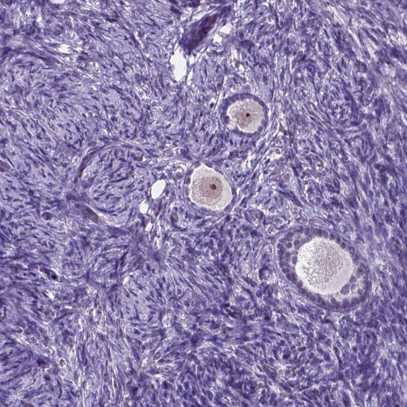 Immunohistochemical staining of human ovary shows moderate nucleolar positivity in follicle cells.