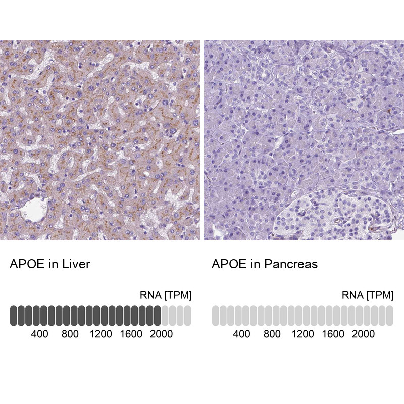 Immunohistochemistry analysis in human liver and pancreas tissues using HPA065539 antibody. Corresponding APOE RNA-seq data are presented for the same tissues.