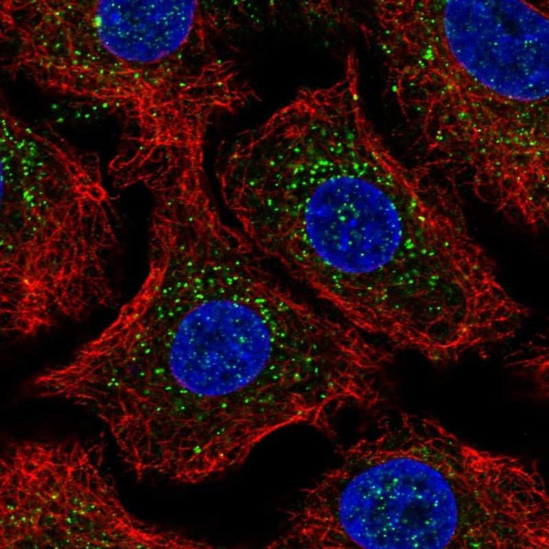 Immunofluorescent staining of human cell line A549 shows localization to vesicles.