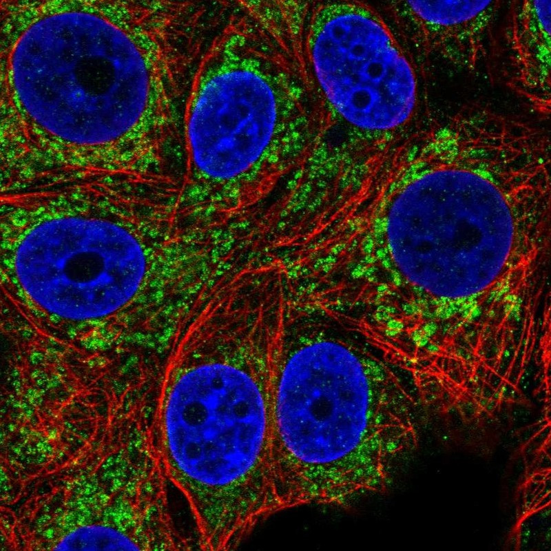 Immunofluorescent staining of human cell line MCF7 shows localization to mitochondria.