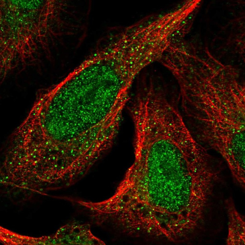 Immunofluorescent staining of human cell line U-2 OS shows localization to nucleoplasm & vesicles.