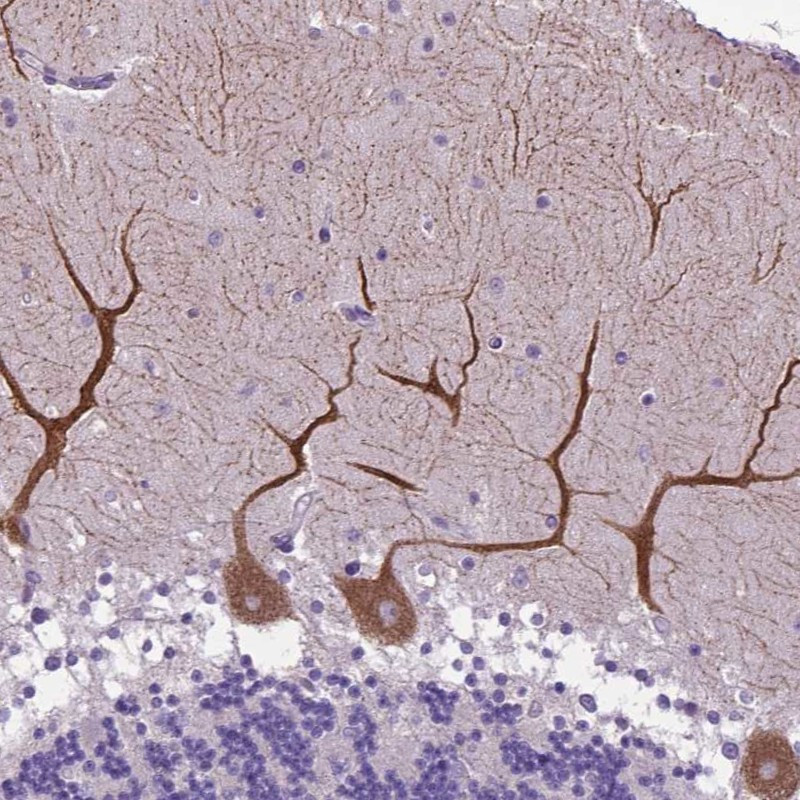 Immunohistochemical staining of human cerebellum shows strong cytoplasmic positivity in Purkinje cells.