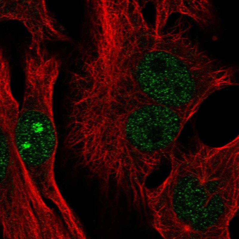 Immunofluorescent staining of human cell line SK-MEL-30 shows localization to nucleus & nucleoli.