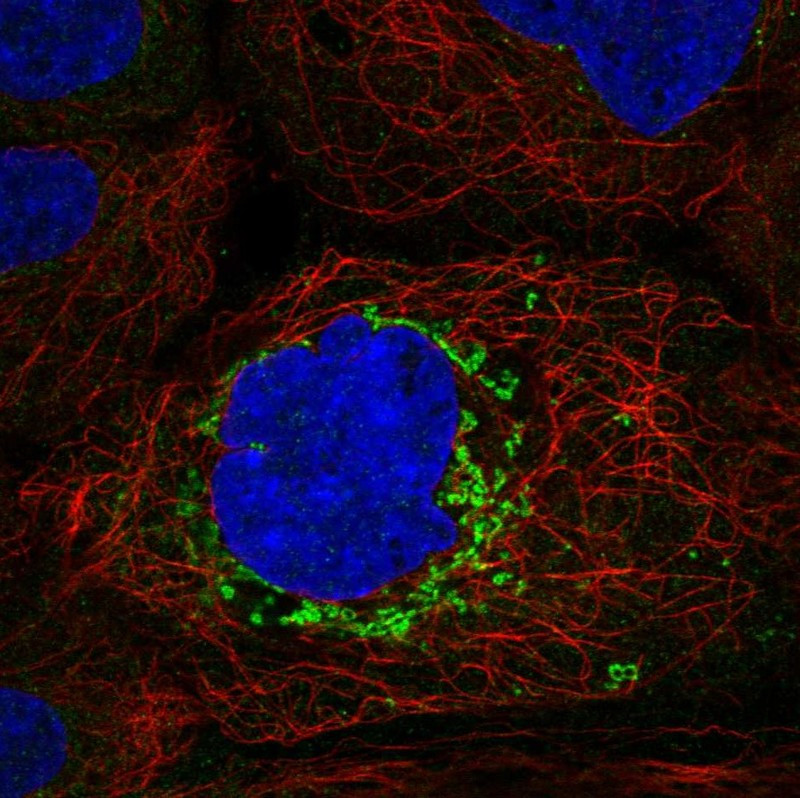 Immunofluorescent staining of human cell line A-431 shows localization to mitochondria.