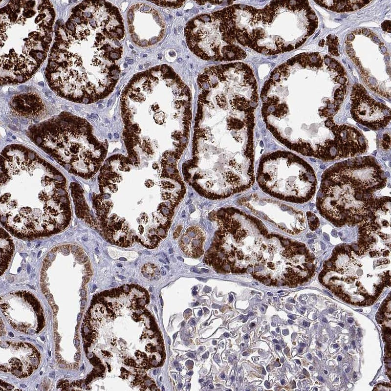 Immunohistochemical staining of human kidney shows strong cytoplasmic positivity in cells in tubules.