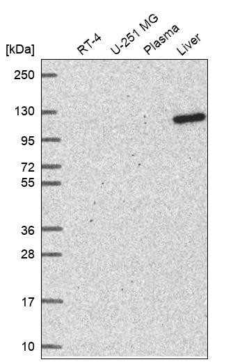 Western blot analysis in human cell line RT-4, human cell line U-251 MG, human plasma and human liver tissue.