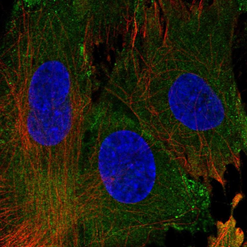 Immunofluorescent staining of human cell line BJ shows localization to plasma membrane.