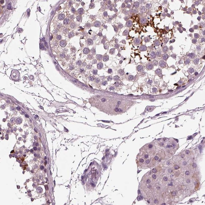 Immunohistochemical staining of human testis shows strong cytoplasmic positivity in cells in seminiferous ducts.