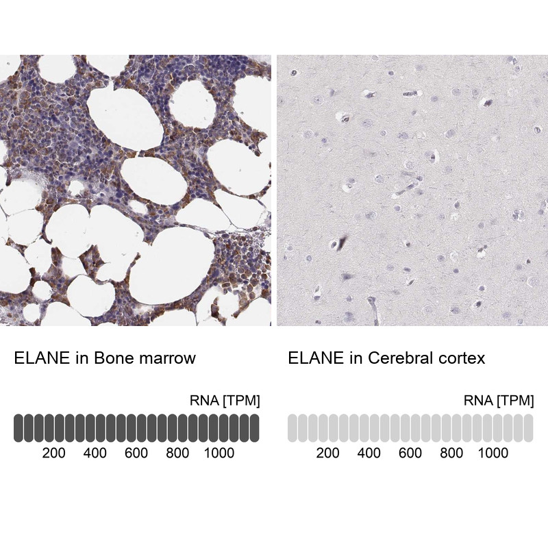 Immunohistochemistry analysis in human bone marrow and cerebral cortex tissues using Anti-ELANE antibody. Corresponding ELANE RNA-seq data are presented for the same tissues.