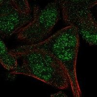 Immunofluorescent staining of human cell line RH-30 shows localization to nucleoplasm.
