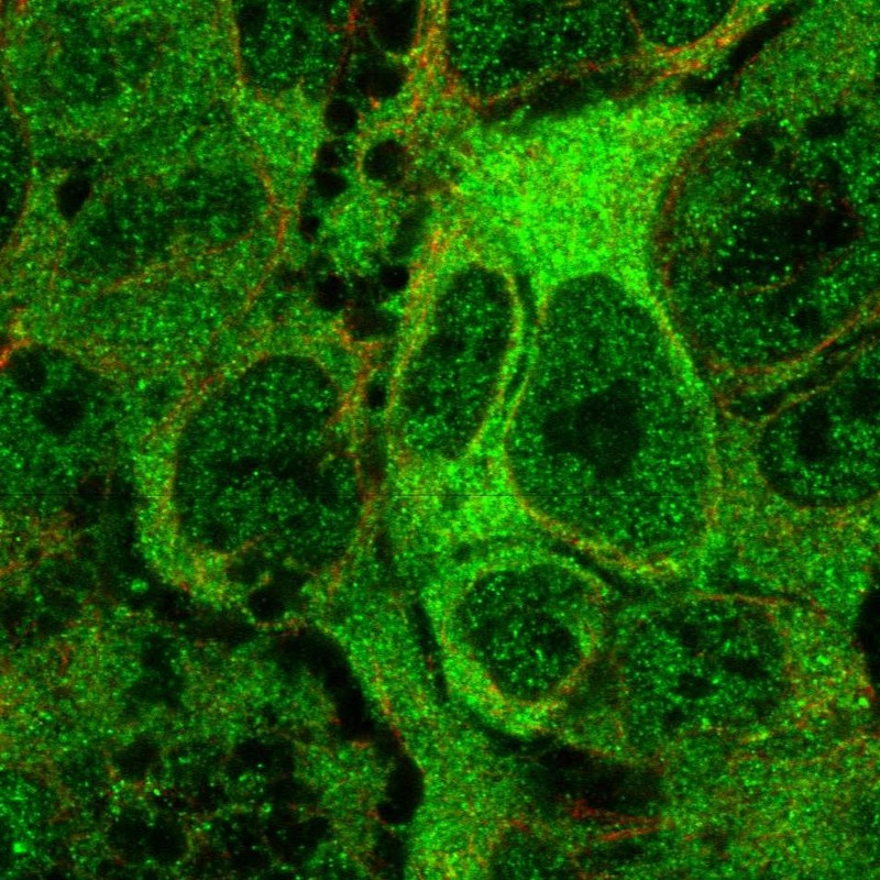 Immunofluorescent staining of human cell line CACO-2 shows localization to nucleoplasm & cytosol.