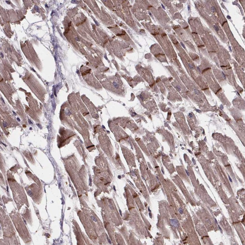 Immunohistochemical staining of human heart muscle shows moderate cytoplasmic and membranous positivity in myocytes.