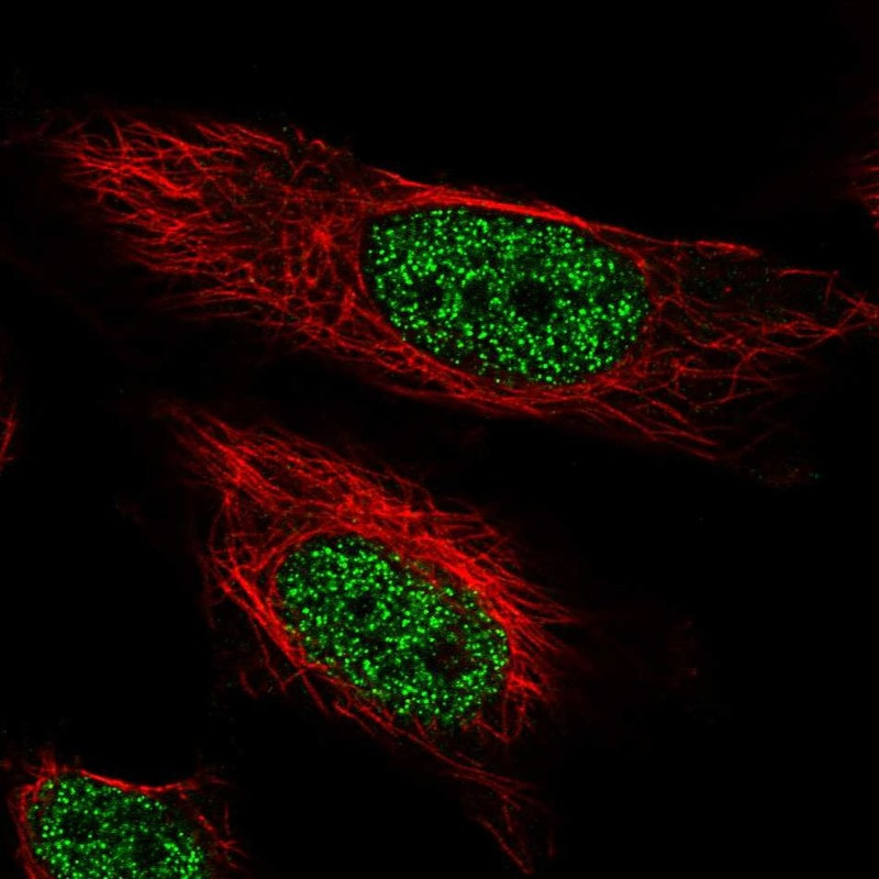 Immunofluorescent staining of human cell line U-251 MG shows localization to nucleoplasm.
