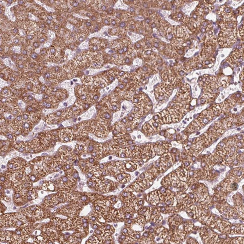 Immunohistochemical staining of human liver shows strong cytoplamsic positivity in hepatocytes.