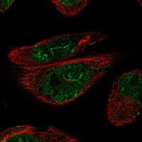 Immunofluorescent staining of human cell line RH-30 shows localization to nucleoplasm, nuclear membrane & mitochondria.