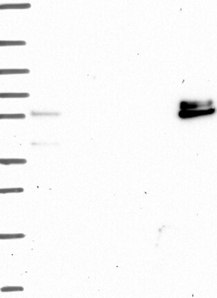 Lane 1: Marker [kDa] 250, 130, 95, 72, 55, 36, 28, 17, 10 | Lane 2: RT4 | Lane 3: U-251 MG | Lane 4: Human Plasma | Lane 5: Liver | Lane 6: Tonsil