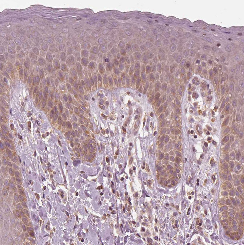 Immunohistochemical staining of human skin shows moderate cytoplasmic positivity in squamous epithelial cells.