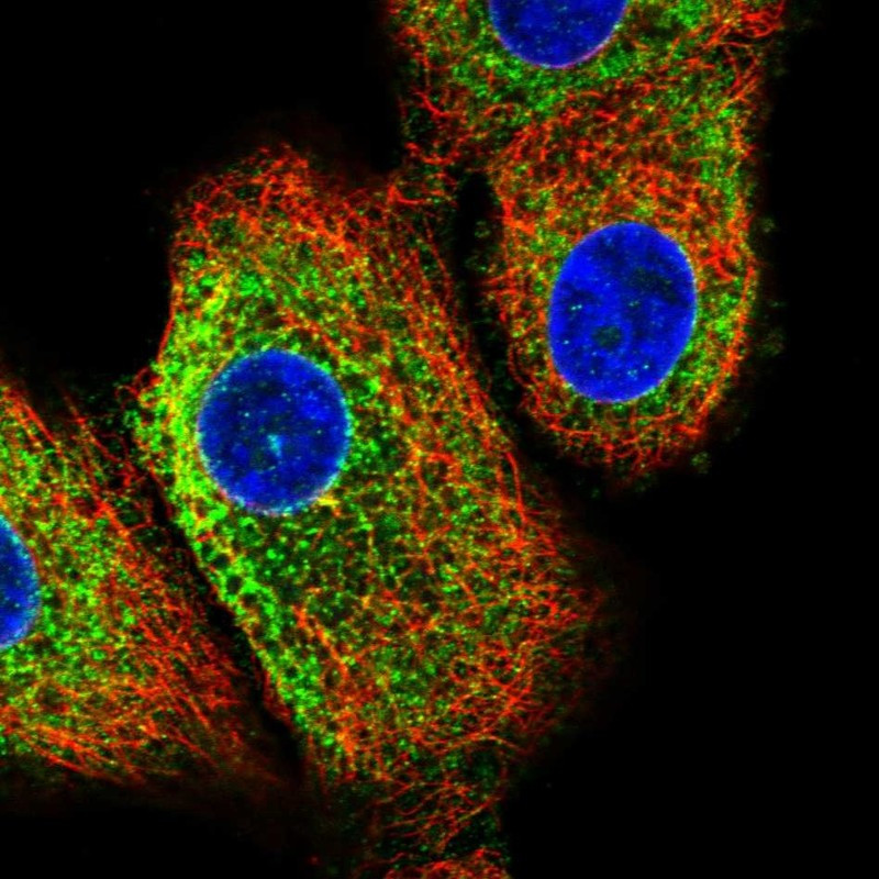 Immunofluorescent staining of human cell line A549 shows localization to endoplasmic reticulum.