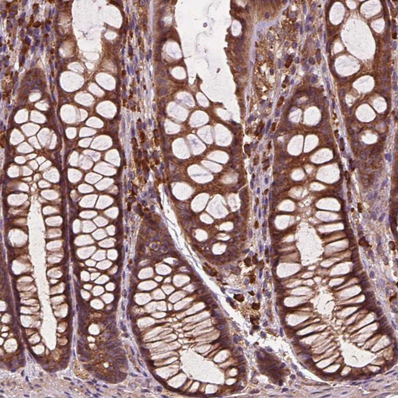 Immunohistochemical staining of human colon shows moderate cytoplasmic positivity in glandular cells.