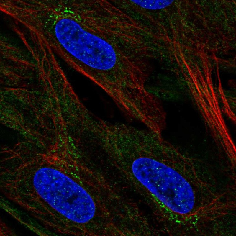 Immunofluorescent staining of human cell line BJ shows localization to cytosol & the Golgi apparatus.