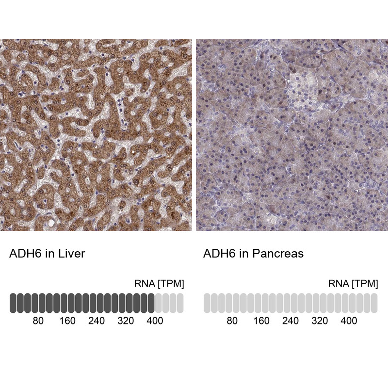 Immunohistochemistry analysis in human liver and pancreas tissues using Anti-ADH6 antibody. Corresponding ADH6 RNA-seq data are presented for the same tissues.