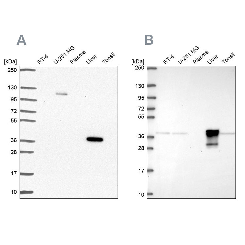 Western blot analysis using Anti-ADH6 antibody HPA067946 (A) shows similar pattern to independent antibody HPA069081 (B).