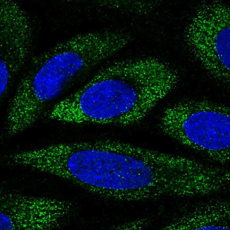 Immunofluorescent staining of human cell line SiHa shows localization to cytosol.