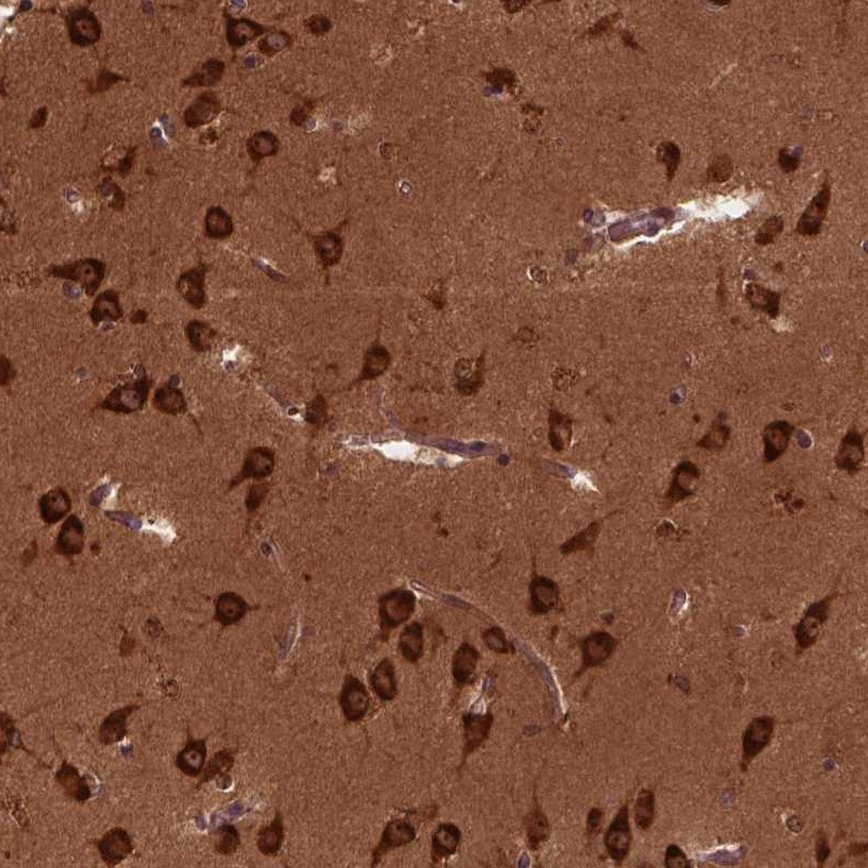 Immunohistochemical staining of human caudate shows strong cytoplasmic and nucleolar positivity in neuronal cells.