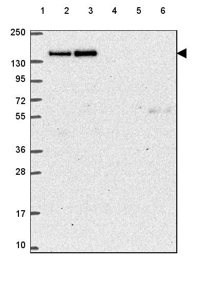 Lane 1: Marker [kDa] 250, 130, 95, 72, 55, 36, 28, 17, 10<br/>Lane 2: Human cell line RT-4<br/>Lane 3: Human cell line U-251 MG<br/>Lane 4: Human plasma<br/>Lane 5: Human Liver tissue<br/>Lane 6: Human Tonsil tissue