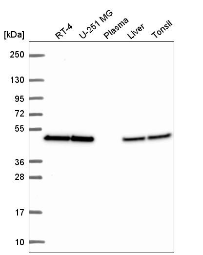 Western blot analysis in human cell line RT-4, human cell line U-251 MG, human plasma, human liver tissue and human tonsil tissue.