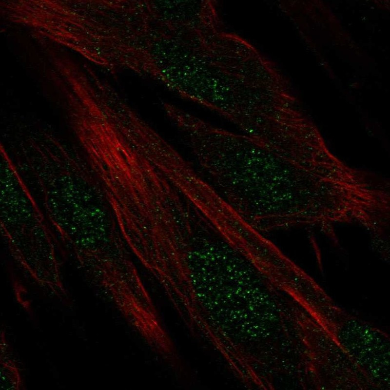Immunofluorescent staining of human cell line ASC TERT1 shows localization to nucleoplasm.
