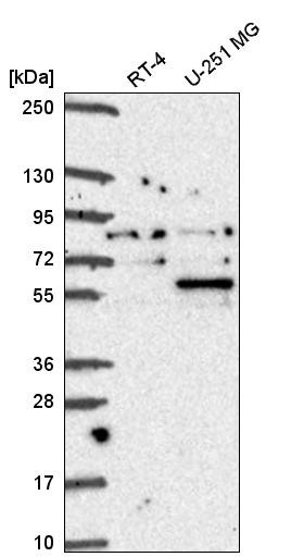 Western blot analysis in human cell line RT-4 and human cell line U-251 MG.