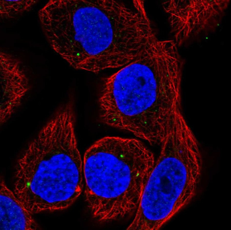 Immunofluorescent staining of human cell line HaCaT shows localization to vesicles.
