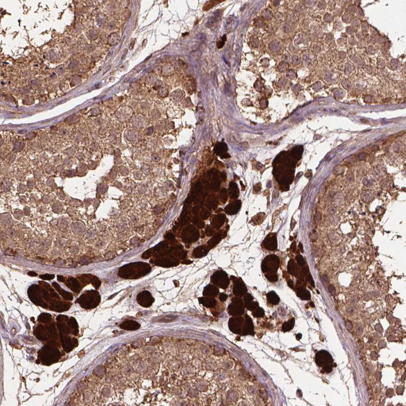 Immunohistochemical staining of human testis shows strong cytoplasmic positivity in Leydig cells.