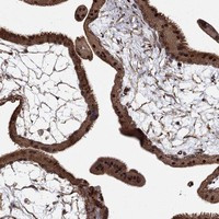 Immunohistochemical staining of human placenta shows strong cytoplasmic positivity in trophoblastic cells.