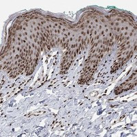 Immunohistochemical staining of human skin shows strong nuclear positivity in epidermal cells.
