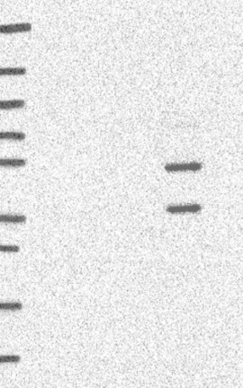 Lane 1: Marker [kDa] 250, 130, 95, 72, 55, 36, 28, 17, 10 | Lane 2: RT4 | Lane 3: U-251 MG | Lane 4: Human Plasma | Lane 5: Liver | Lane 6: Tonsil