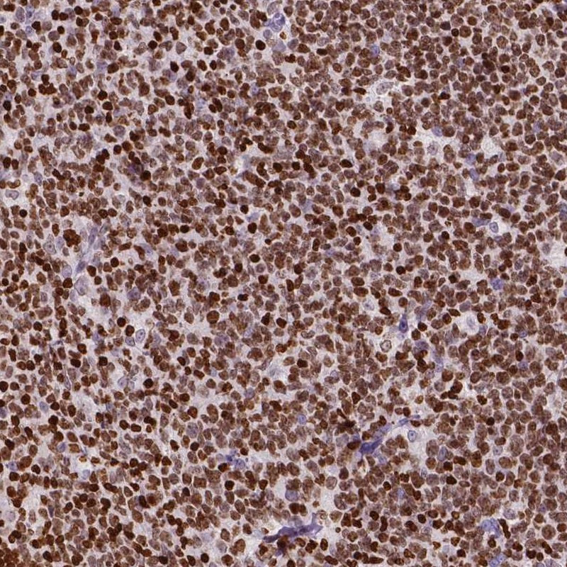 Immunohistochemical staining of human tonsil shows moderate nuclear positivity in germinal center cells.