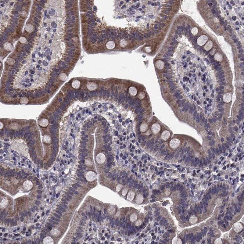 Immunohistochemical staining of human duodenum shows strong cytoplasmic positivity in glandular cells.