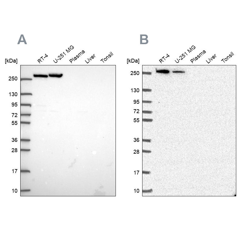 Western blot analysis using Anti-CAD antibody HPA069341 (A) shows similar pattern to independent antibody HPA057266 (B).