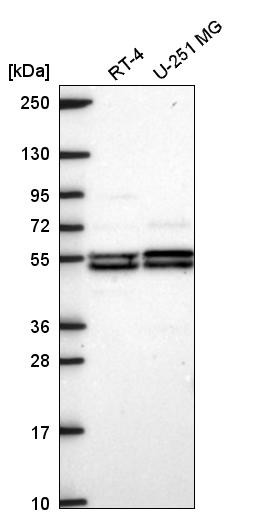 Western blot analysis in human cell line RT-4 and human cell line U-251 MG.