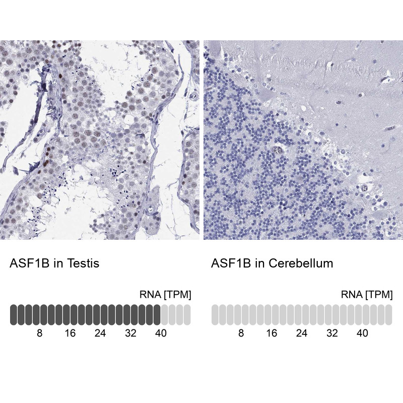 Immunohistochemistry analysis in human testis and cerebellum tissues using Anti-ASF1B antibody. Corresponding ASF1B RNA-seq data are presented for the same tissues.