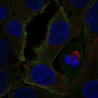 Immunofluorescent staining of human cell line RT4 shows localization to plasma membrane.