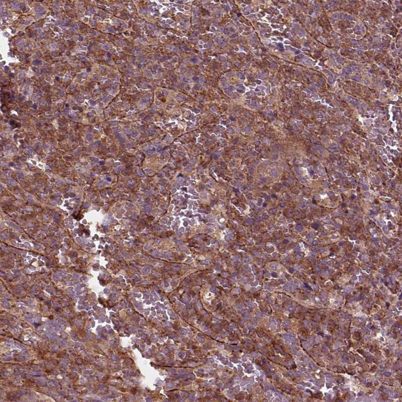 Immunohistochemical staining of human spleen shows cytoplasmic positivity in red pulp.