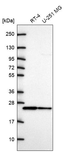 Western blot analysis in human cell line RT-4 and human cell line U-251 MG.