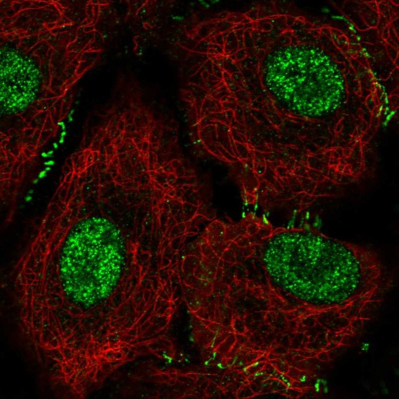Immunofluorescent staining of human cell line A549 shows localization to nucleoplasm & cell junctions.