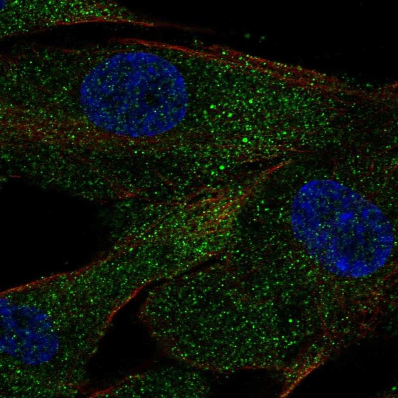 Immunofluorescent staining of human cell line ASC TERT1 shows localization to vesicles.